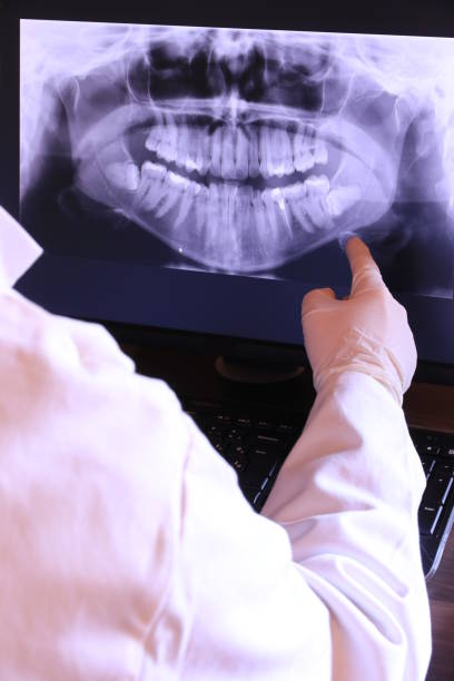 Best Broken Tooth Emergency  in East Pasadena, CA